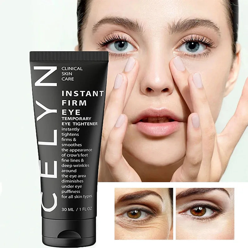 Cëlyn™ - Øyeoppstrammende krem med anti-aldringseffekt