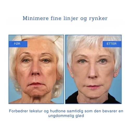 Botox Ansiktsserum by Rask Oslo