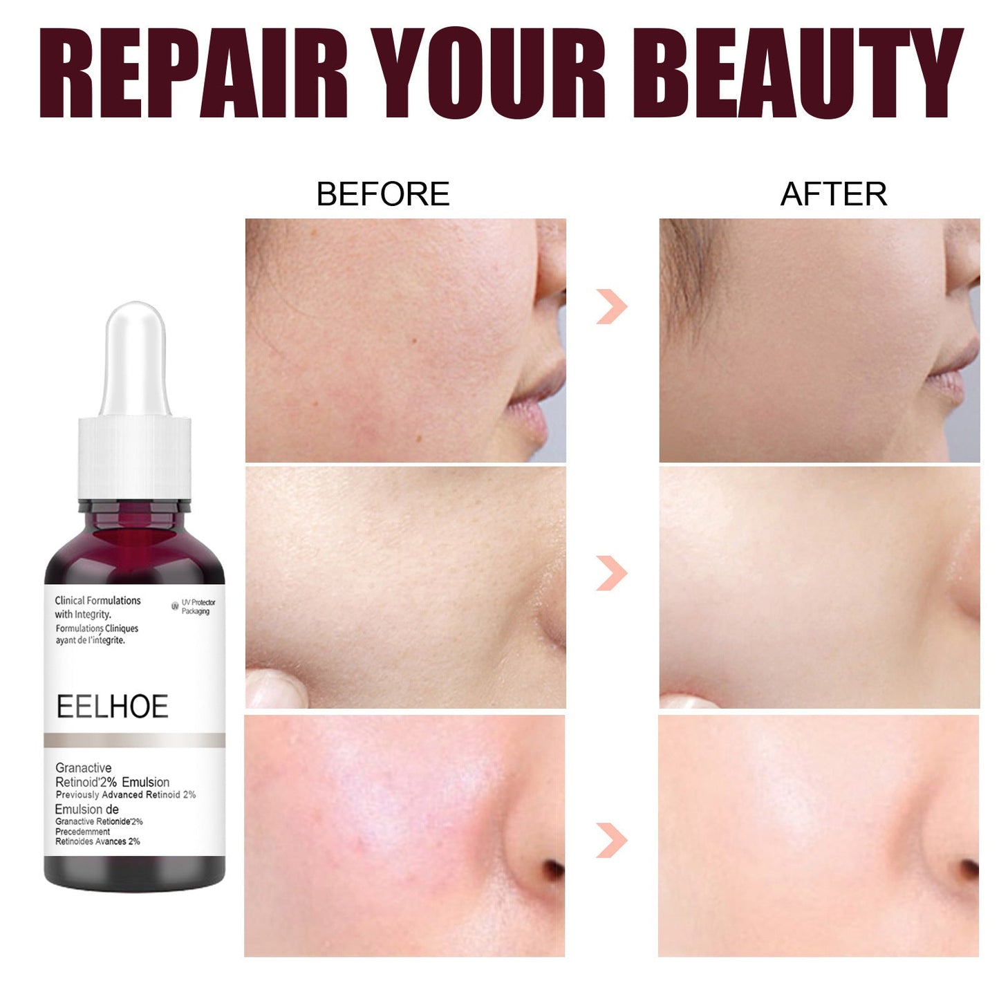 EELHOE™ | Pore Clear-serum